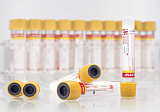 Пробирка вакуумная «Acti-Fine®» для забора венозной крови с активатором свёртывания, гелем: размер 13x75 мм, объем: 4,0 мл