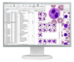 Автоматическая система анализа клеток крови Vision Hema® Ultimate